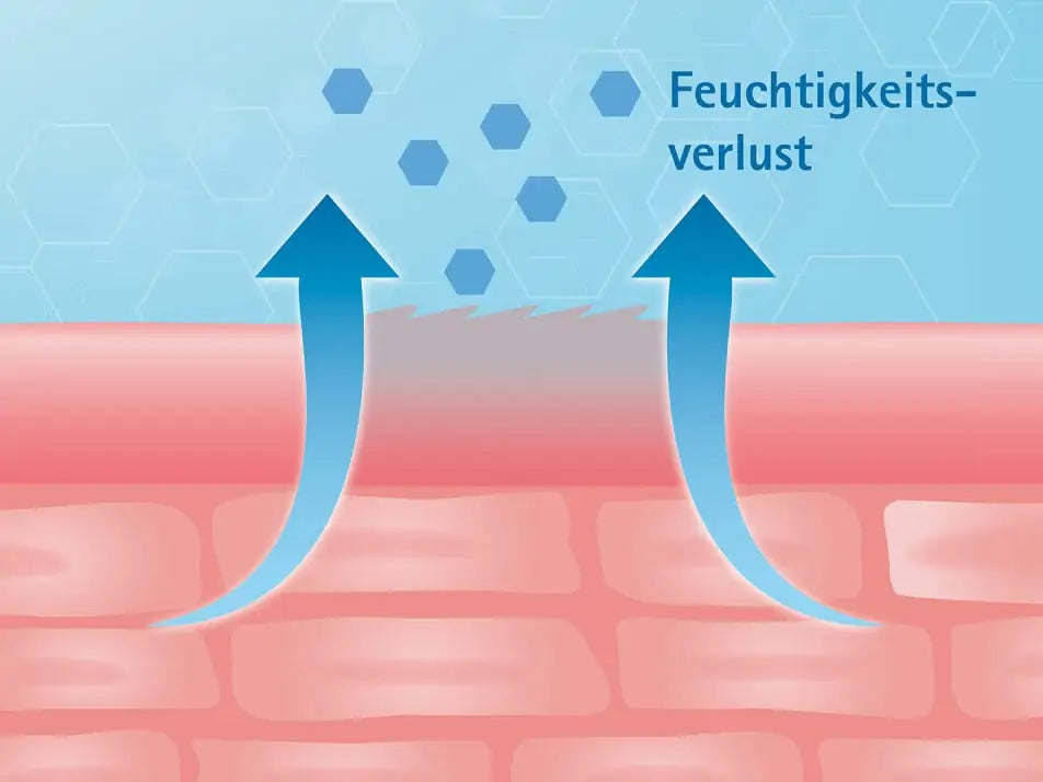 Abbildung des feuchtigkeitsverlusts der Haut