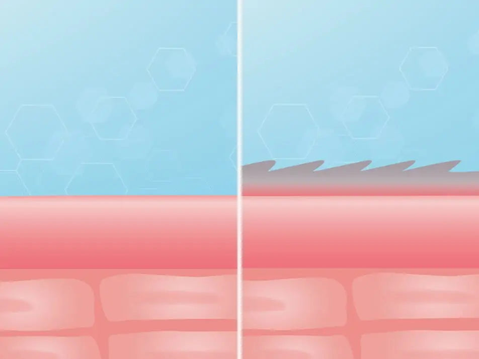 Abbildung einer gesunden Haut