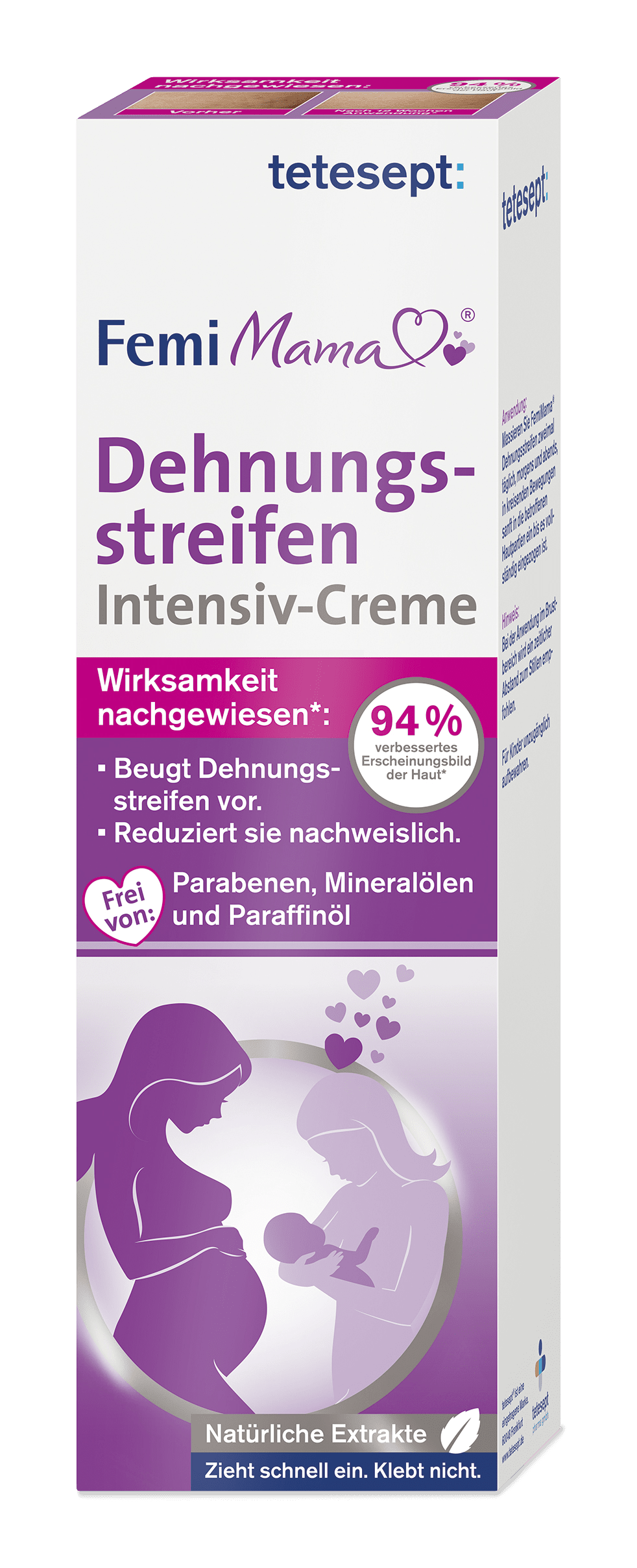 Femi Mama® Dehnungsstreifen